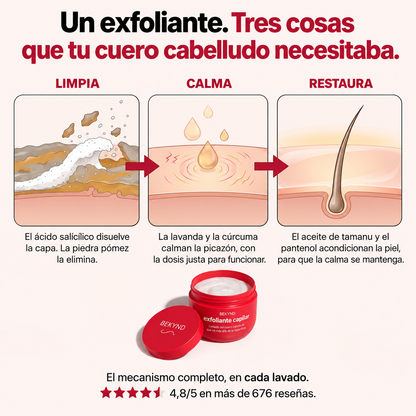 Alivio real para la caspa, la picazón y las impurezas del cuero cabelludo